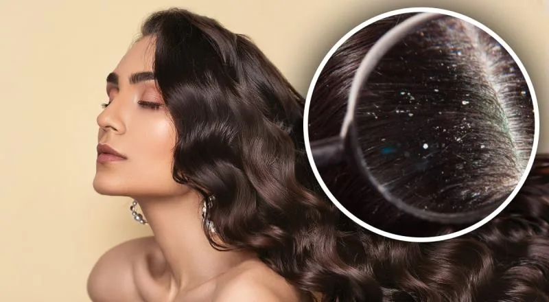 самолікування лупи