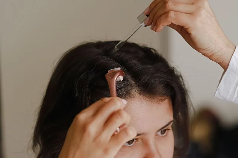 лечение выпадения волос